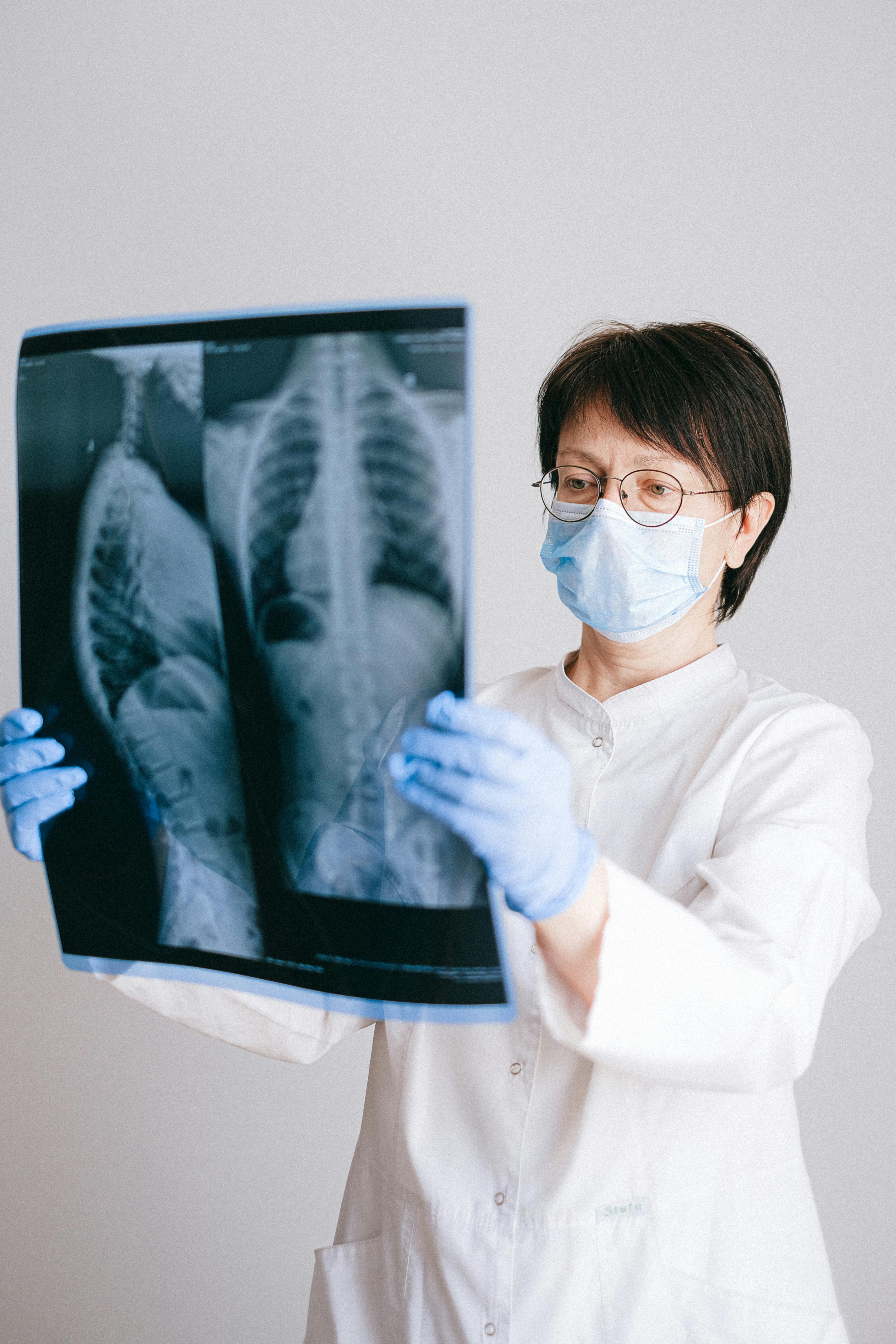 A doctor looking at an xray